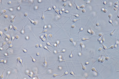 Moule (Mytilus edulis) - Spermatozoïdes x250